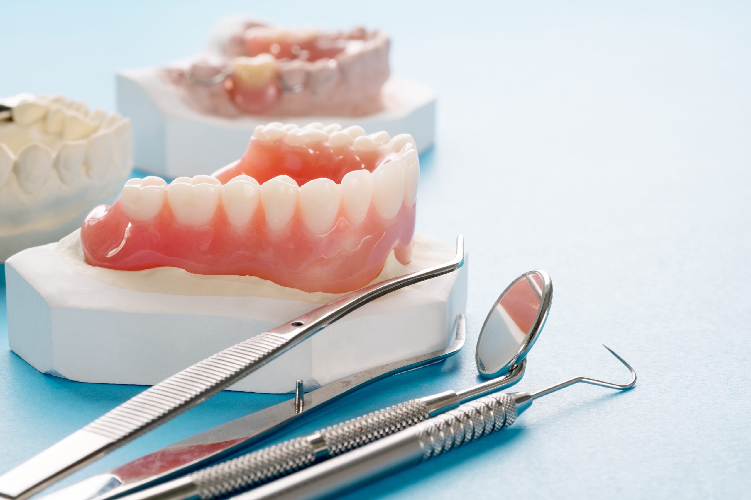 Quels sont les différents types de prothèses dentaires – Prothèse complète amovible