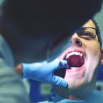 biopsie-bouche
