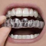 what is an occlusal plate