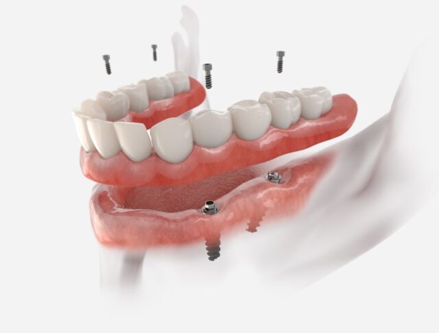 Image en vedette de l'article