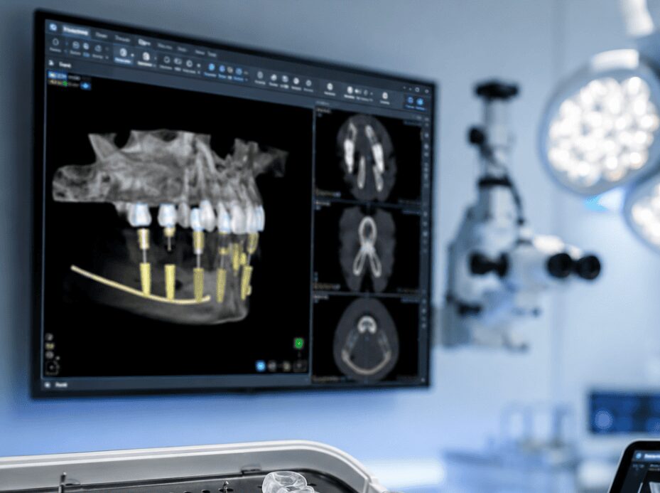 Image du module